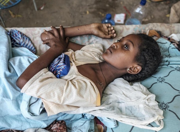 Ethiopia pains strife