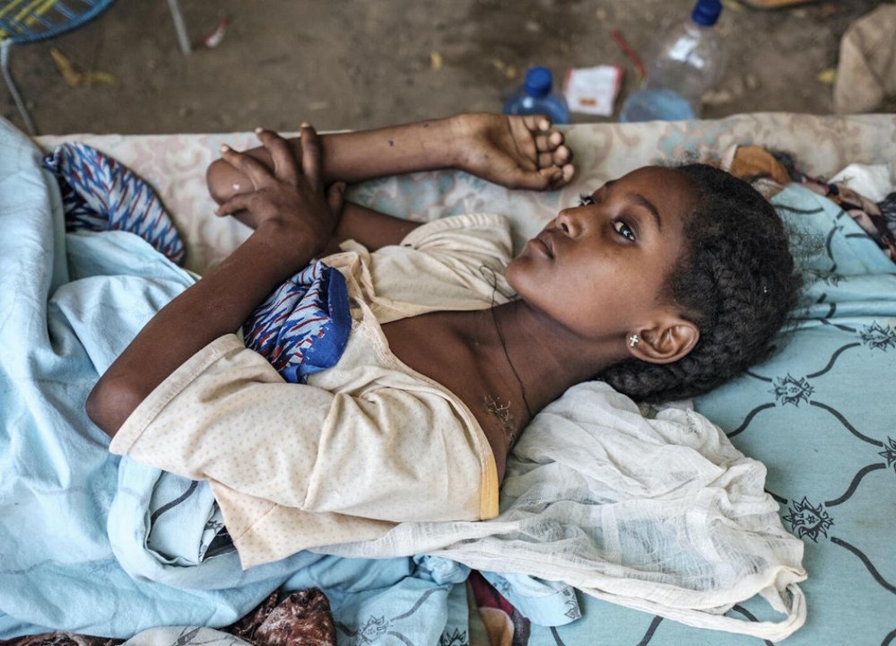 Ethiopia pains strife